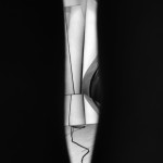 NEWStudioThroughLegs