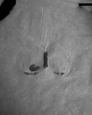 941 imprint (from hand and body)