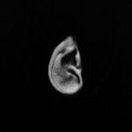 TC_Ear_low